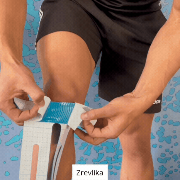 Zrevlika™ – Zglob koljena – 10 komada