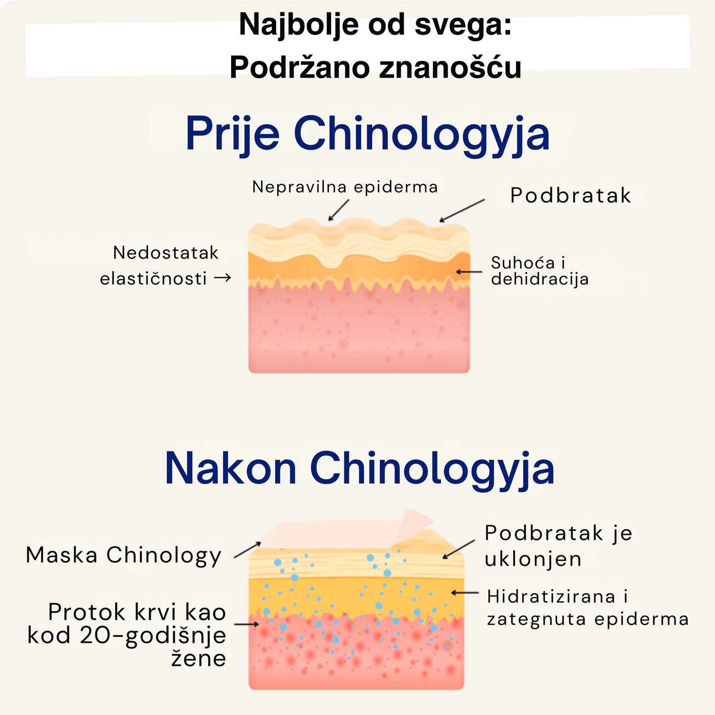 Chinology™ Lift – Udvostručujemo vašu narudžbu SAMO DANAS!