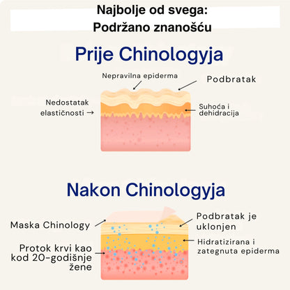 Chinology™ Lift – Udvostručujemo vašu narudžbu SAMO DANAS!
